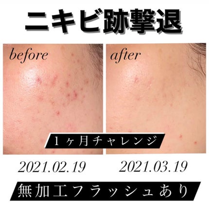 ドクタージャルト シカペア クリーム (第2世代)/Dr.Jart+/フェイスクリームを使ったクチコミ(1枚目)