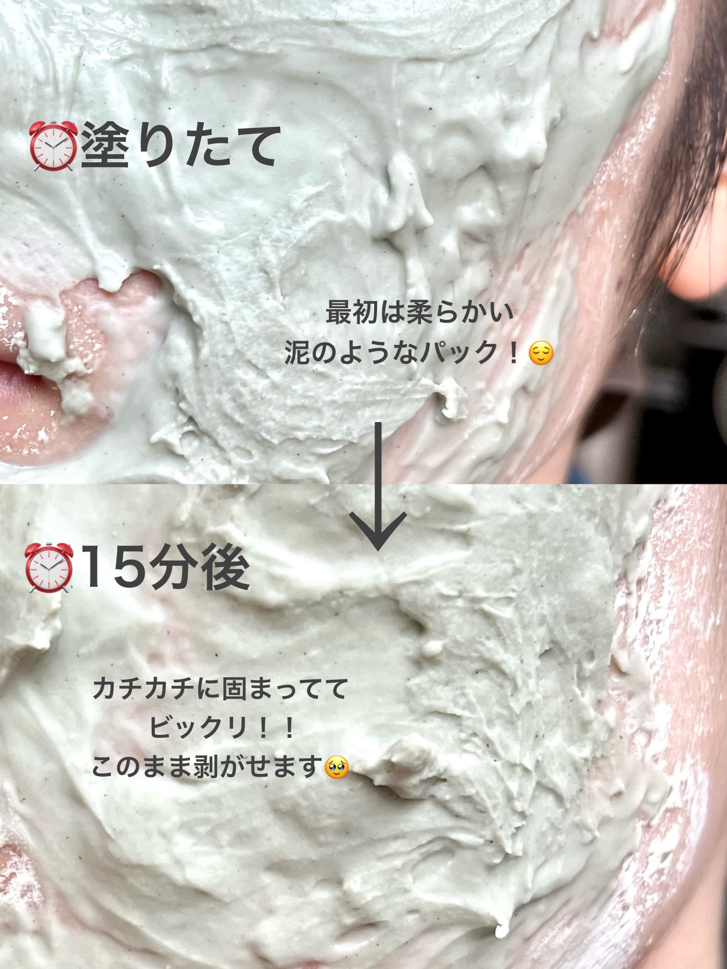 ドクダミ化粧水/ONE THING/化粧水を使ったクチコミ(4枚目)