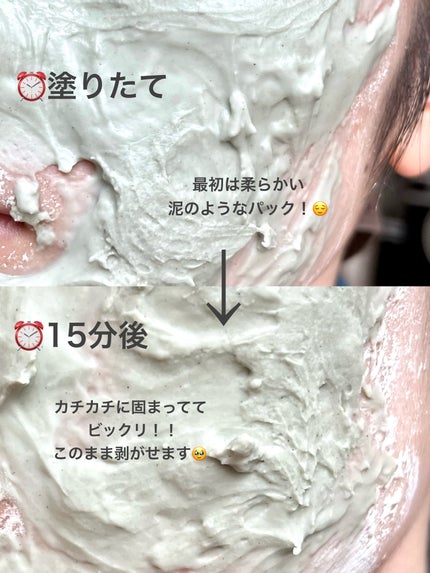 ドクダミ化粧水/ONE THING/化粧水を使ったクチコミ(4枚目)