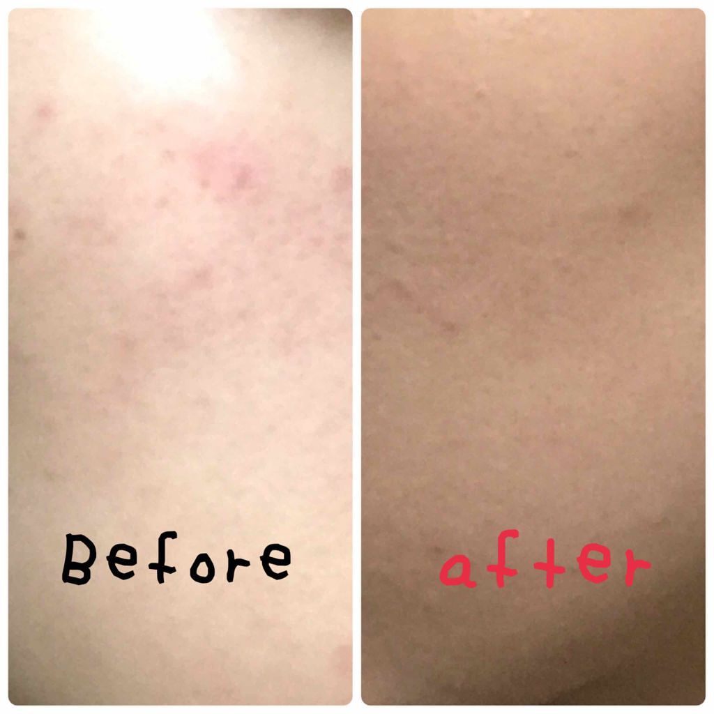 VT×BTS/VT/クリーム・エマルジョンファンデーションを使ったクチコミ（2枚目）