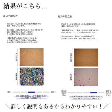skin analysis kit（肌診断キット）/coco.skin/その他スキンケアを使ったクチコミ（5枚目）