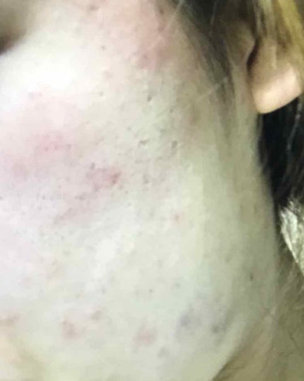 白潤 薬用美白化粧水(しっとりタイプ)/肌ラボ/化粧水を使ったクチコミ(2枚目)