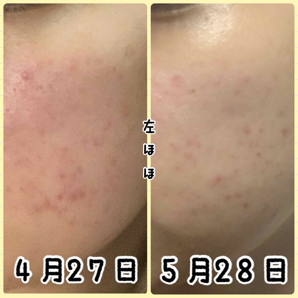 ソフティモ 薬用ホワイト クレンジングウォッシュ/ソフティモ/洗顔フォームを使ったクチコミ（3枚目）