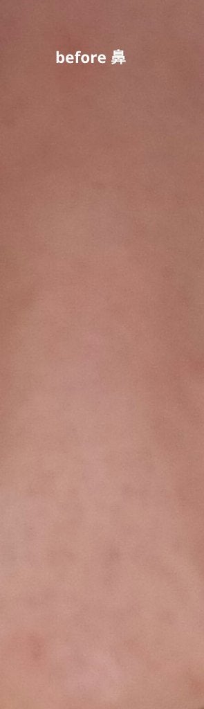 ミラミックス/ZO Skin Health/フェイスクリームを使ったクチコミ(6枚目)