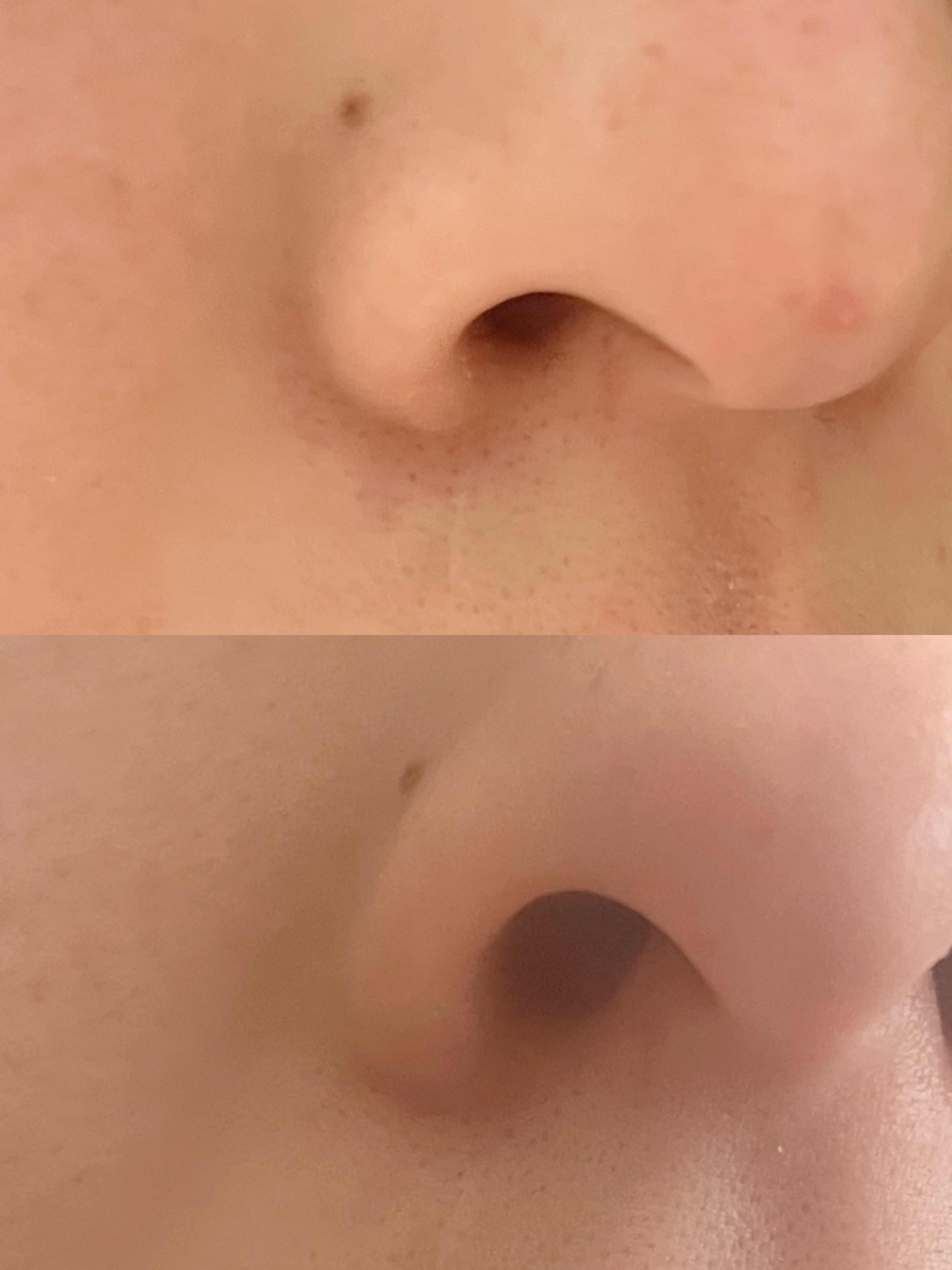 Kooジェルクリーム/Koo/乳液を使ったクチコミ（3枚目）