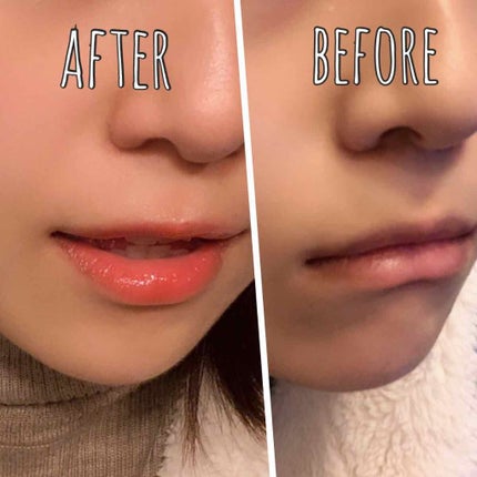 ミネラルリッププランパー/エトヴォス/リッププランパーを使ったクチコミ(2枚目)