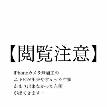 ハトムギ化粧水(ナチュリエ スキンコンディショナー R )/ナチュリエ/化粧水を使ったクチコミ（3枚目）