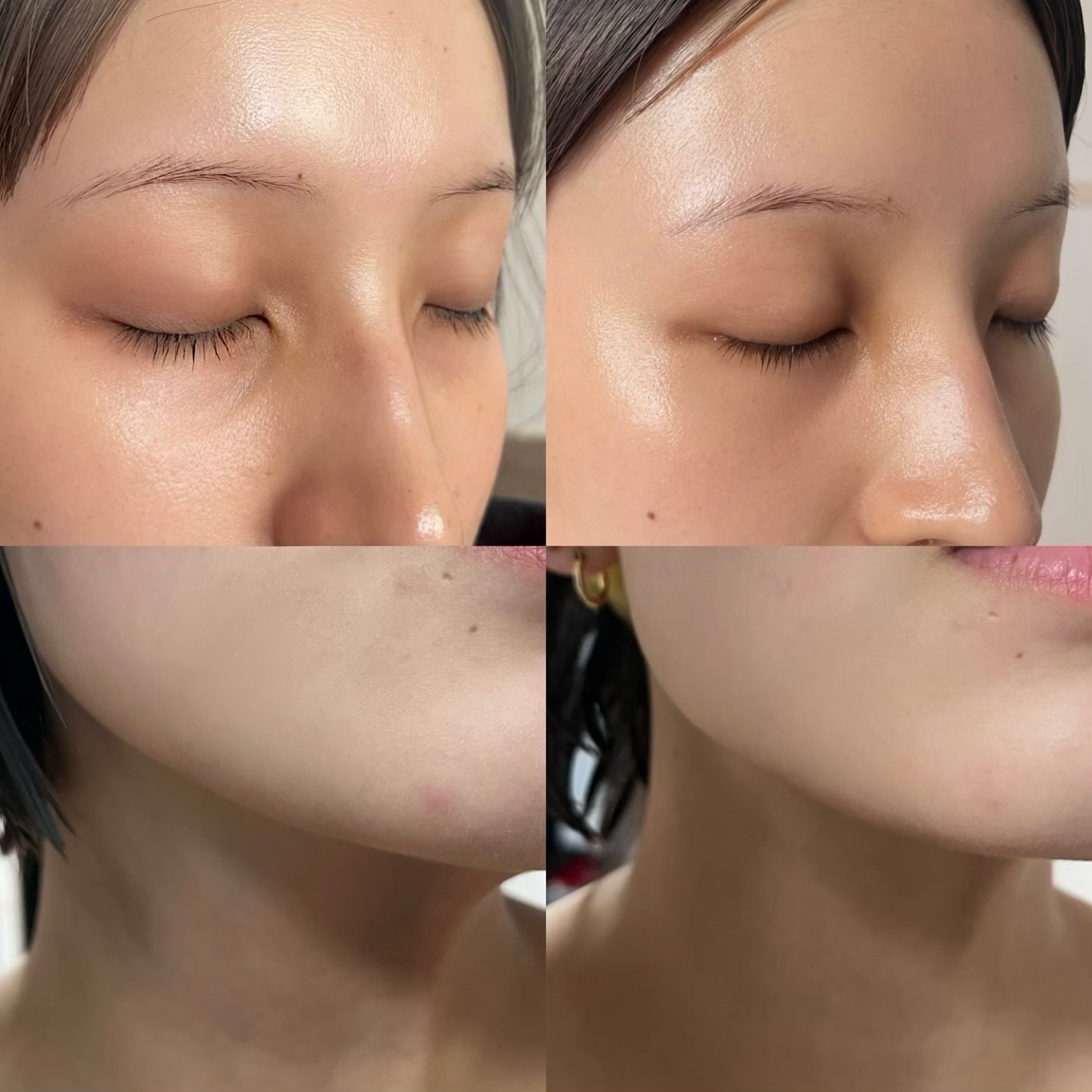 マジックティーツリーオイル/ブラン/フェイスオイルを使ったクチコミ（3枚目）