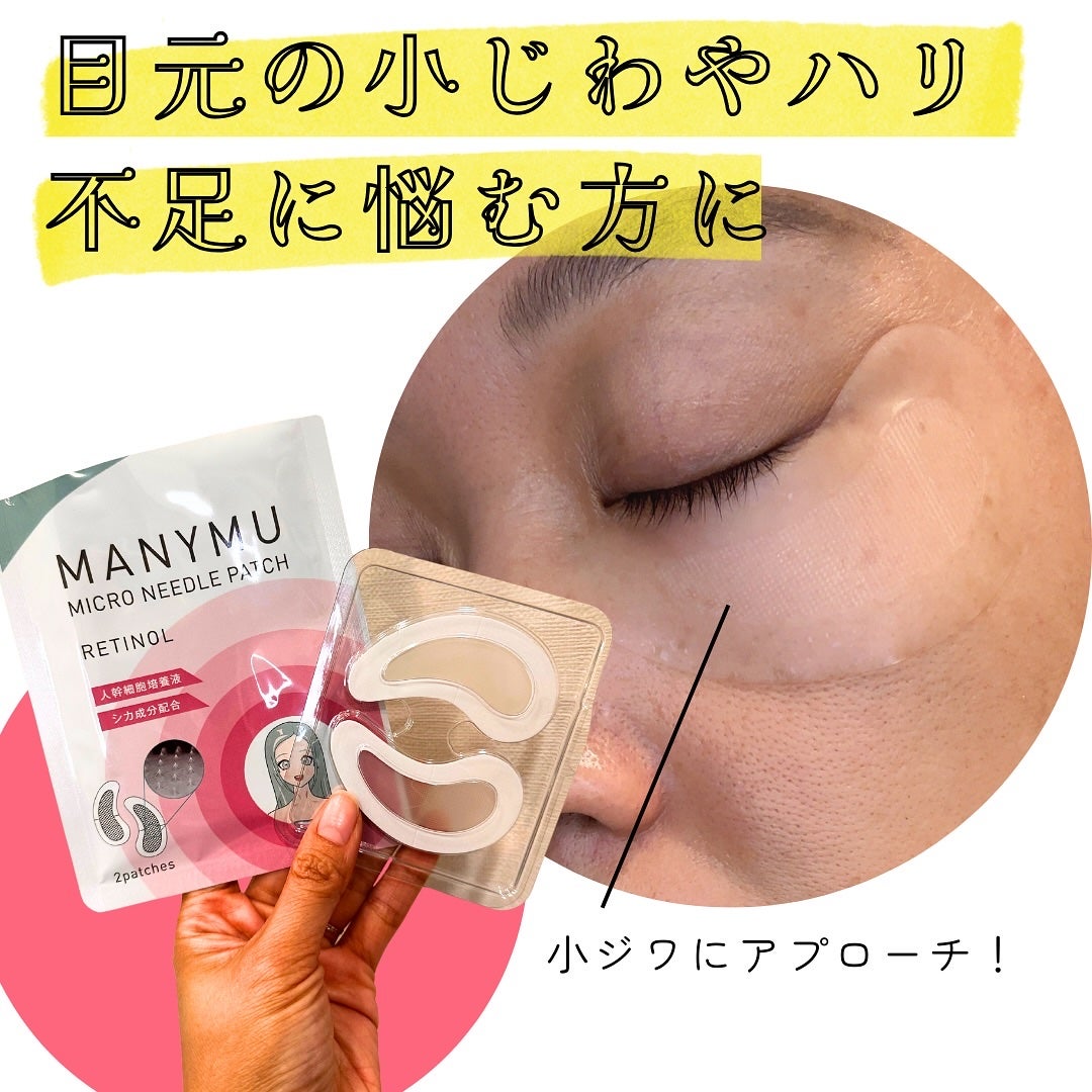 マイクロニードルパッチ シカ/MANYMU/シートマスク・パックを使ったクチコミ(3枚目)