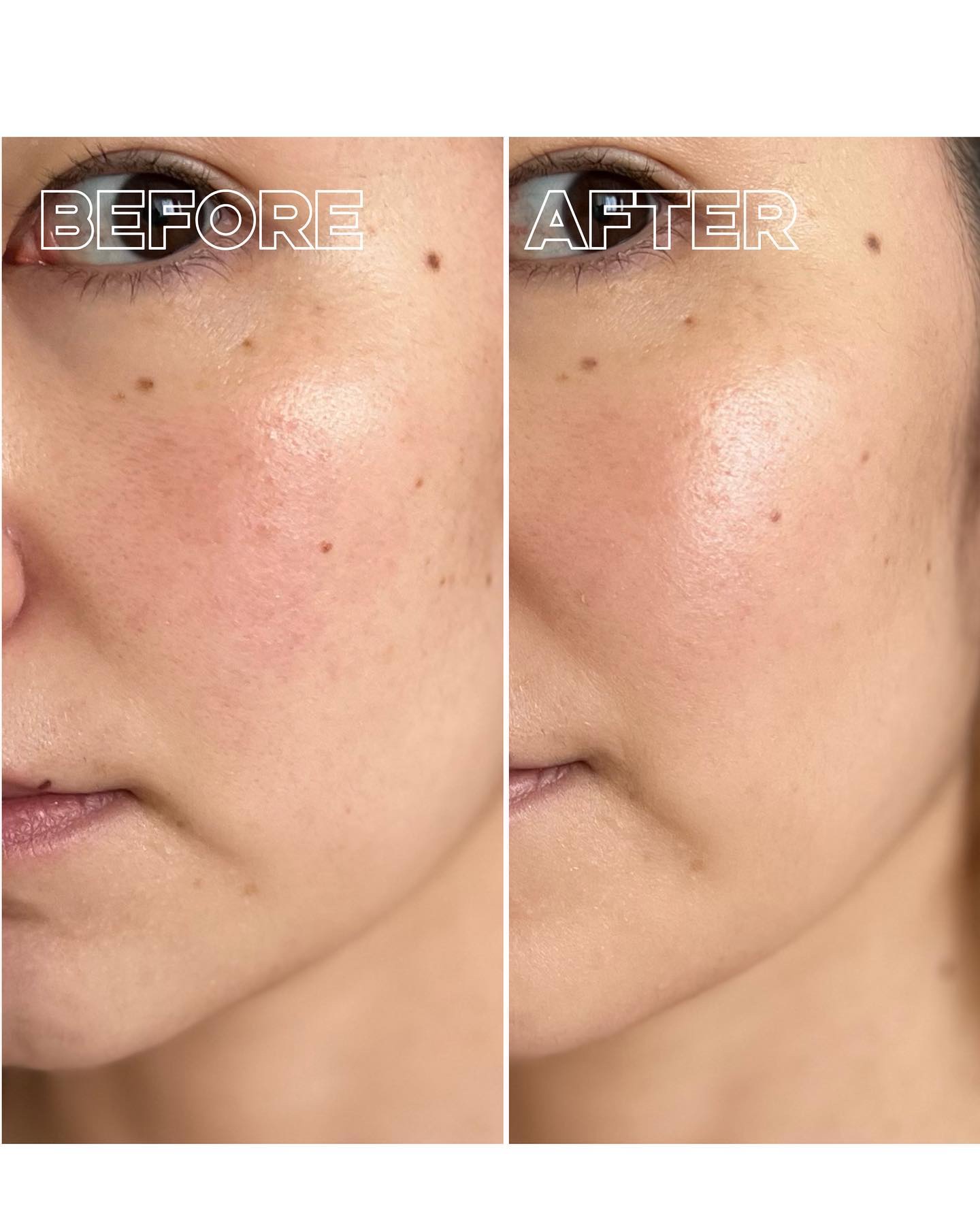 アンビシャス ビューティーセラムファンデーション 02/SINN PURETÉ/リキッドファンデーションを使ったクチコミ（3枚目）