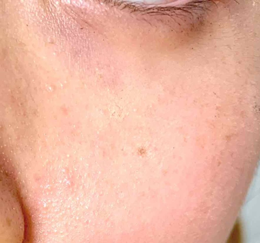 AT毛穴カバーパウダー/Art Collection/プレストパウダーを使ったクチコミ(3枚目)