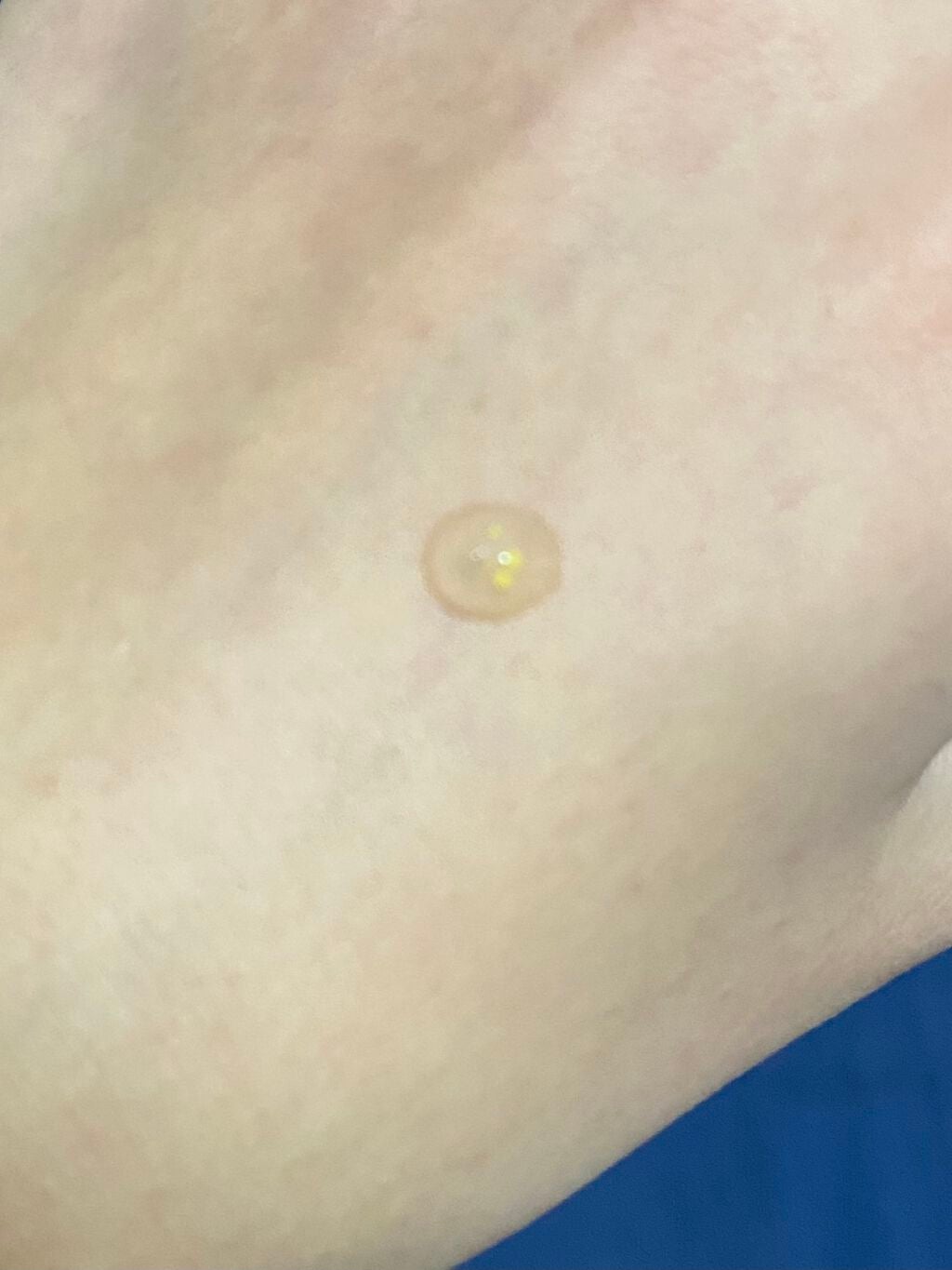 Power10フォーミュラ Q10エフェクター/It's skin/美容液を使ったクチコミ(5枚目)