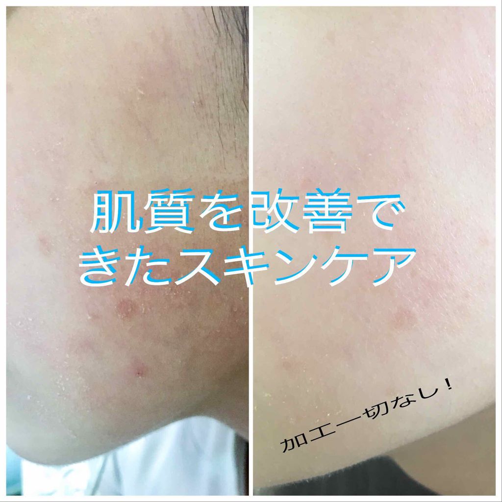 ウォッシャブル コールド クリーム/ちふれ/クレンジングクリームを使ったクチコミ(1枚目)