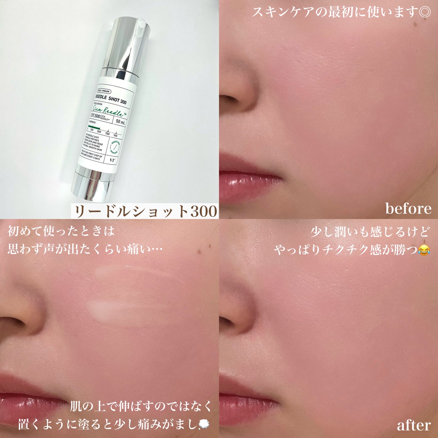 CICA デイリースージングマスク/VT/シートマスク・パックを使ったクチコミ(4枚目)