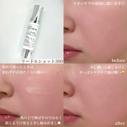 CICA デイリースージングマスク/VT/シートマスク・パックを使ったクチコミ(4枚目)