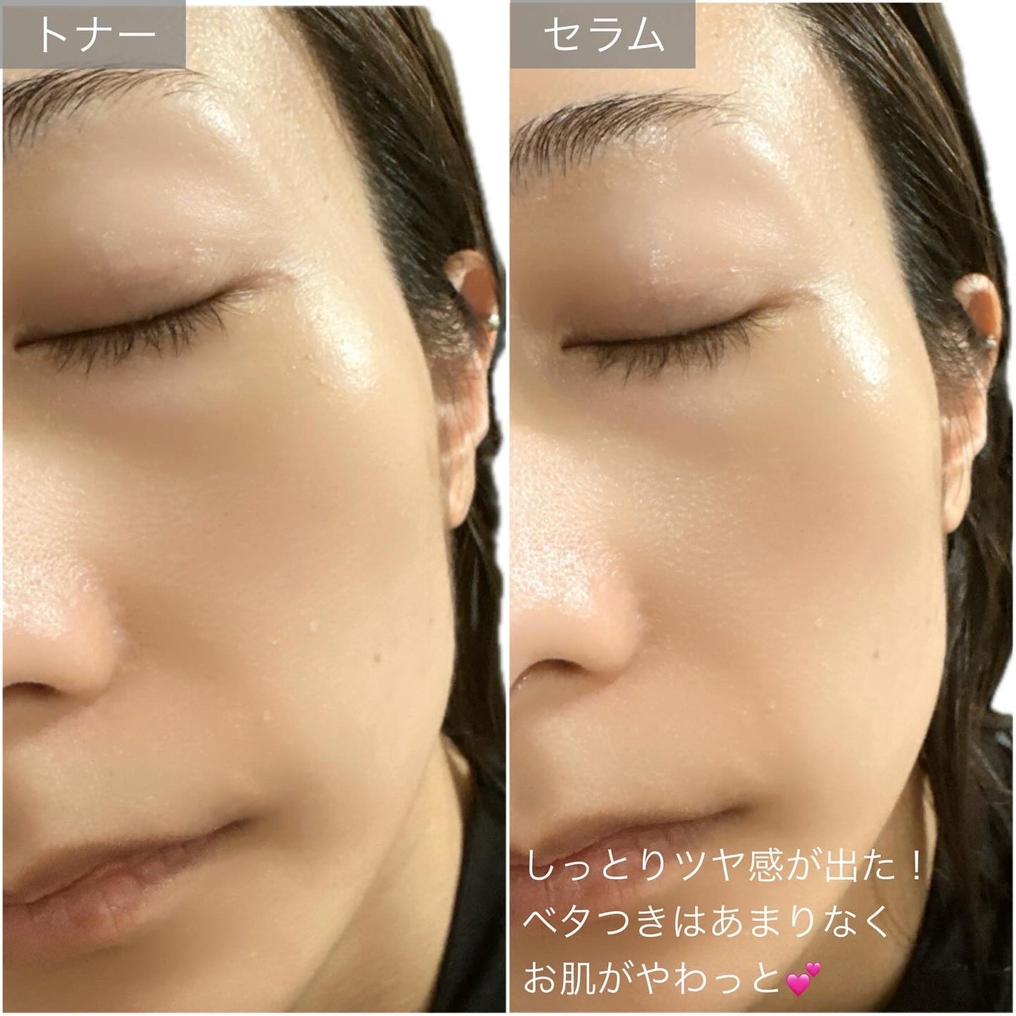 ビタミンブライトニングマスク/ONE THING/シートマスク・パックを使ったクチコミ(8枚目)