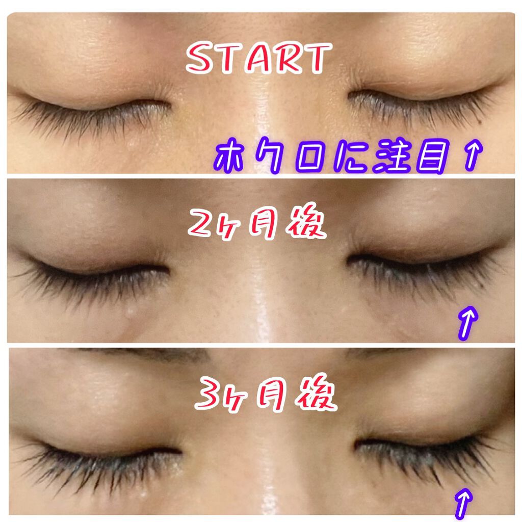 EMAKED（エマーキット）/水橋保寿堂製薬/まつげ美容液を使ったクチコミ（1枚目）