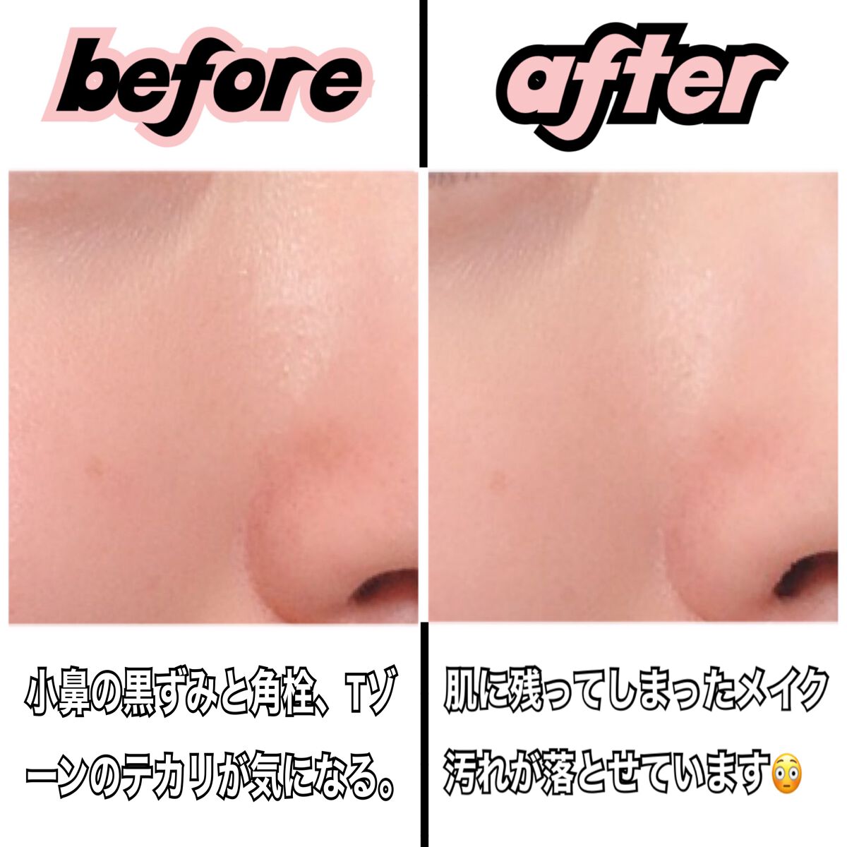 ゾンビビューティー繭毛穴パック/SKIN1004/ピーリングを使ったクチコミ(5枚目)