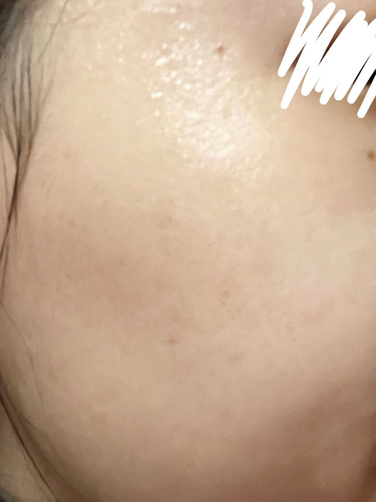 明色美顔水 薬用化粧水/美顔/化粧水を使ったクチコミ(5枚目)