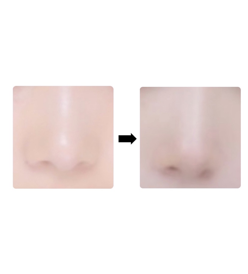 のびーるアイテープ（絆創膏タイプ、レギュラー）/DAISO/二重まぶた用アイテムを使ったクチコミ（3枚目）