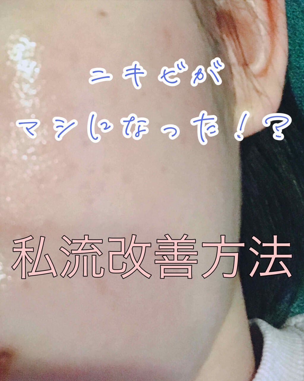 ハトムギ化粧水(ナチュリエ スキンコンディショナー R )/ナチュリエ/化粧水を使ったクチコミ(1枚目)