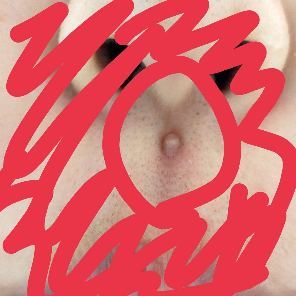 オロナインH軟膏 (医薬品)/オロナイン/その他を使ったクチコミ(2枚目)