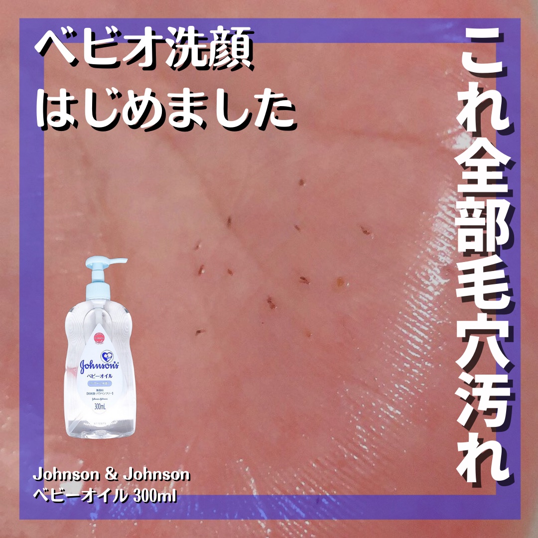 ジョンソン ベビーオイル 無香料/ジョンソンベビー/ボディオイルを使ったクチコミ（1枚目）
