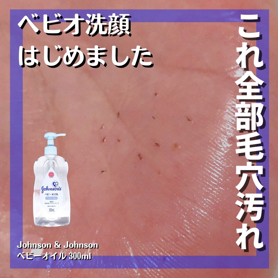 ジョンソン ベビーオイル 無香料/ジョンソンベビー/ボディオイルを使ったクチコミ(1枚目)