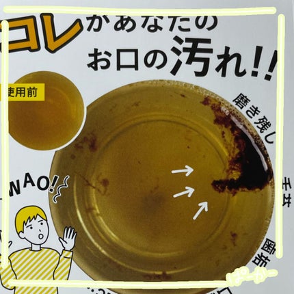 プロポリンス/プロポリンス/マウスウォッシュ・スプレーを使ったクチコミ(3枚目)