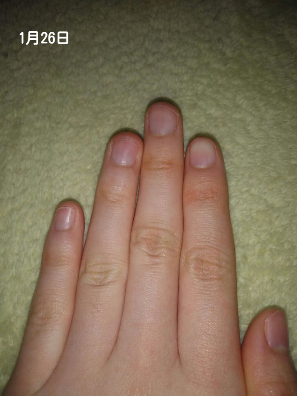 ハンドベール 乾燥 バリアクリーム/メンソレータム/ハンドクリームを使ったクチコミ（1枚目）