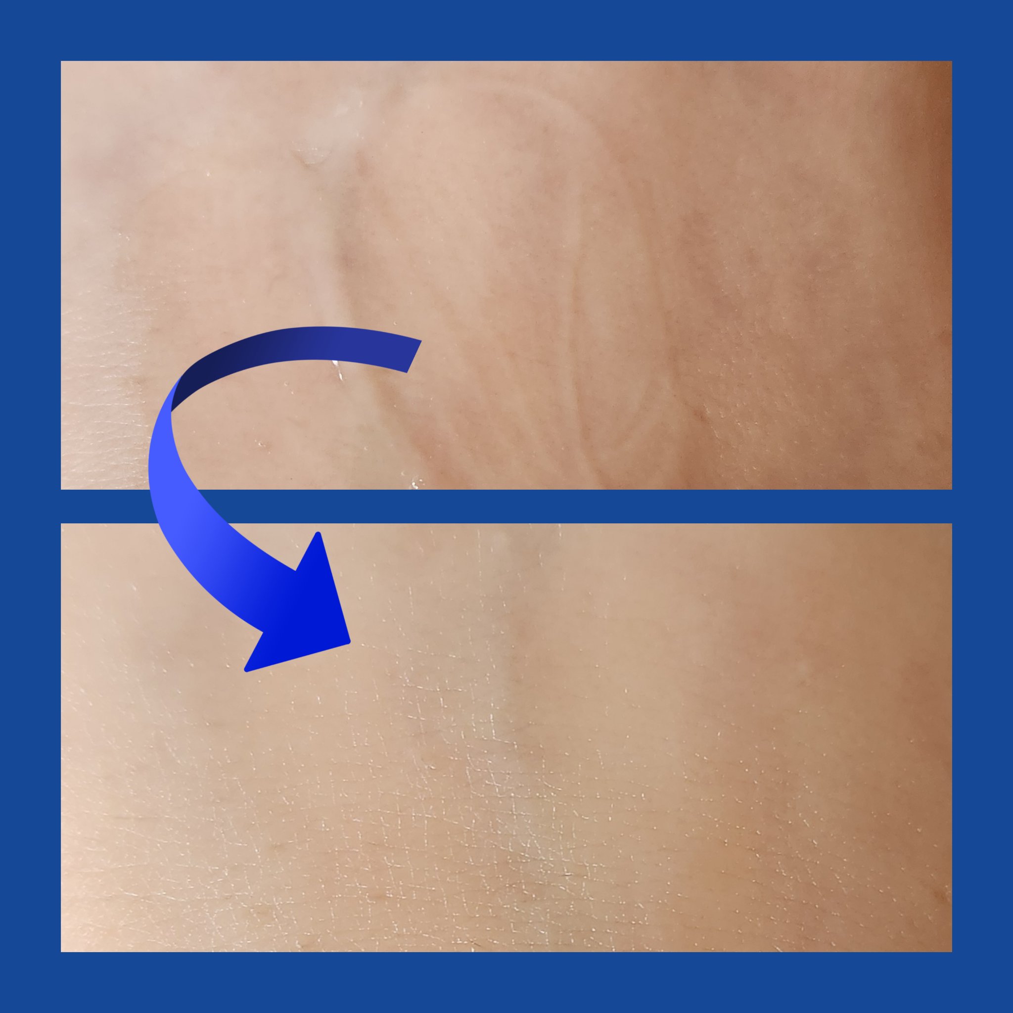 ゼロ1DAYエクソソームショット2000/MEDICUBE/美容液を使ったクチコミ（3枚目）