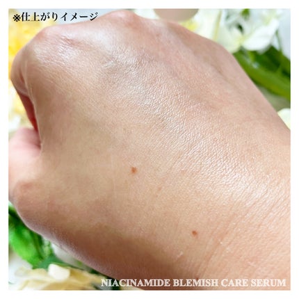 ナイアシンアミドブレミッシュケアセラム/ONE THING/美容液を使ったクチコミ(9枚目)
