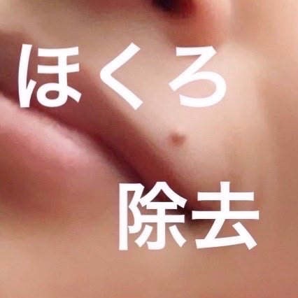 猫派 on LIPS 「ほくろ除去しました!!忘れないうちにメモします。私のほくろは膨..」(1枚目)