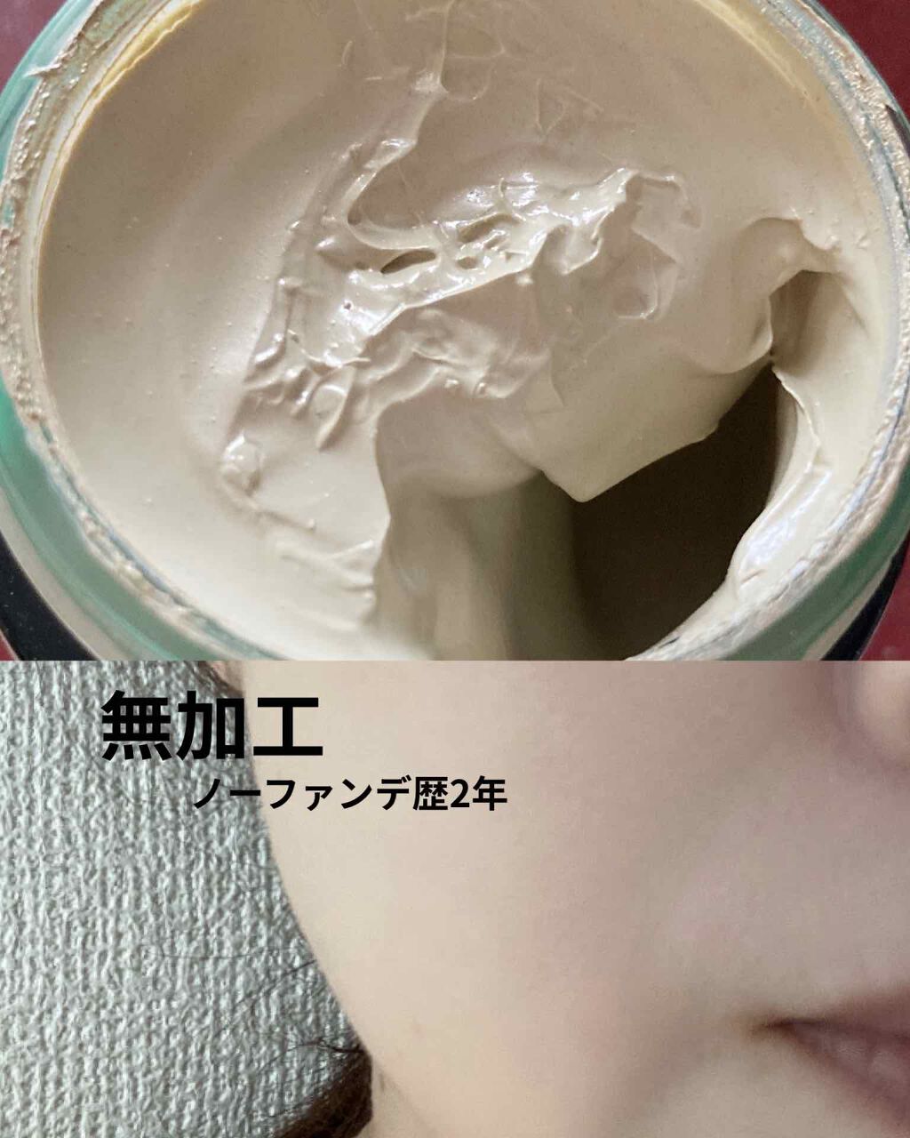 ドクタージャルト シカペア リカバー (第2世代）/Dr.Jart＋/フェイスクリームを使ったクチコミ（2枚目）