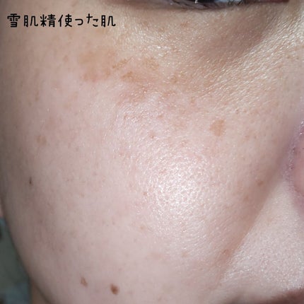 クリアウェルネス ピュア コンク/雪肌精/化粧水を使ったクチコミ(4枚目)