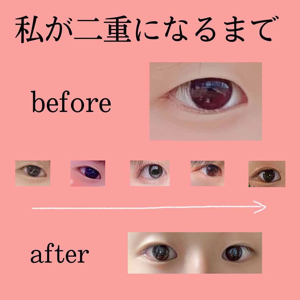 ワンダーアイリッドテープ Extra/D-UP/二重まぶた用アイテムを使ったクチコミ（1枚目）