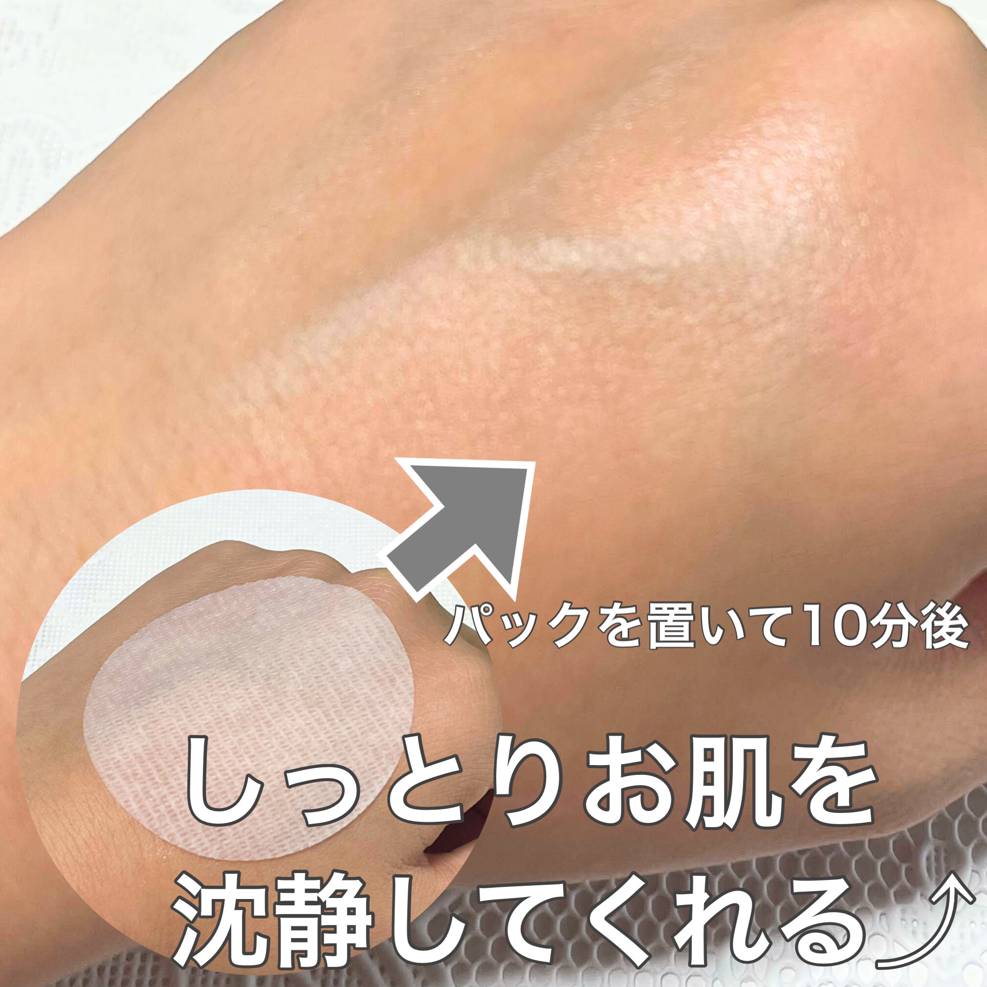 ドクダミカーミングタッチスポットパッド/Abib /トナーパッドを使ったクチコミ（3枚目）