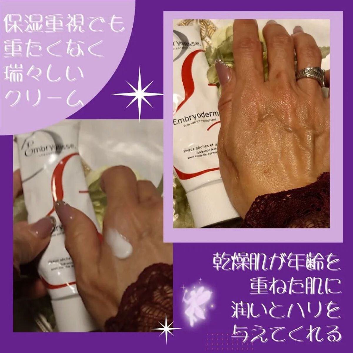 アンブリオデルム モイスチャークリーム/アンブリオリス/フェイスクリームを使ったクチコミ(3枚目)