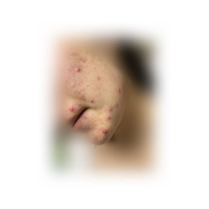 明色美顔水 薬用化粧水/美顔/化粧水を使ったクチコミ(1枚目)