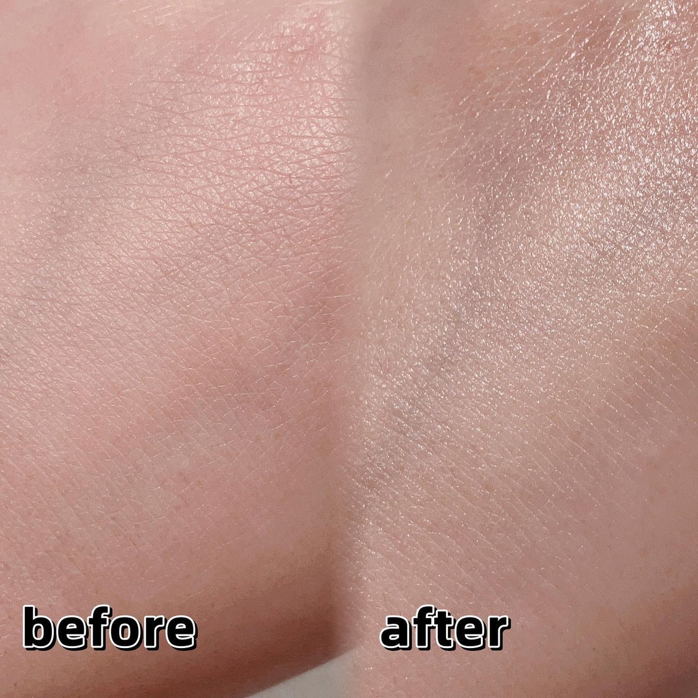 RXザ・ナイアシンアミド15セラム /COSRX/美容液を使ったクチコミ(4枚目)