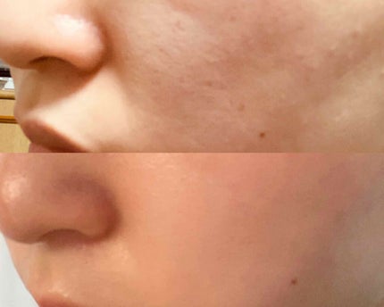 ホワイトコンセントレート/AYURA/美容液を使ったクチコミ(2枚目)