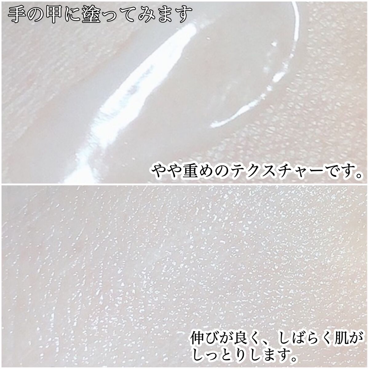 薬用CICAクリーム/アクネスラボ/フェイスクリームを使ったクチコミ（3枚目）