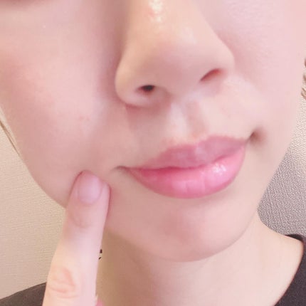 sarako on LIPS 「ビフェスタ リップスクラブバーム&リップセラムパック💋■..」(6枚目)
