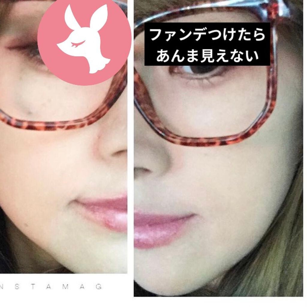 ためしたがり43歳 on LIPS 「これは、シミと戦争をした私の話。産後を含め、シミめっちゃ増えて..」(8枚目)