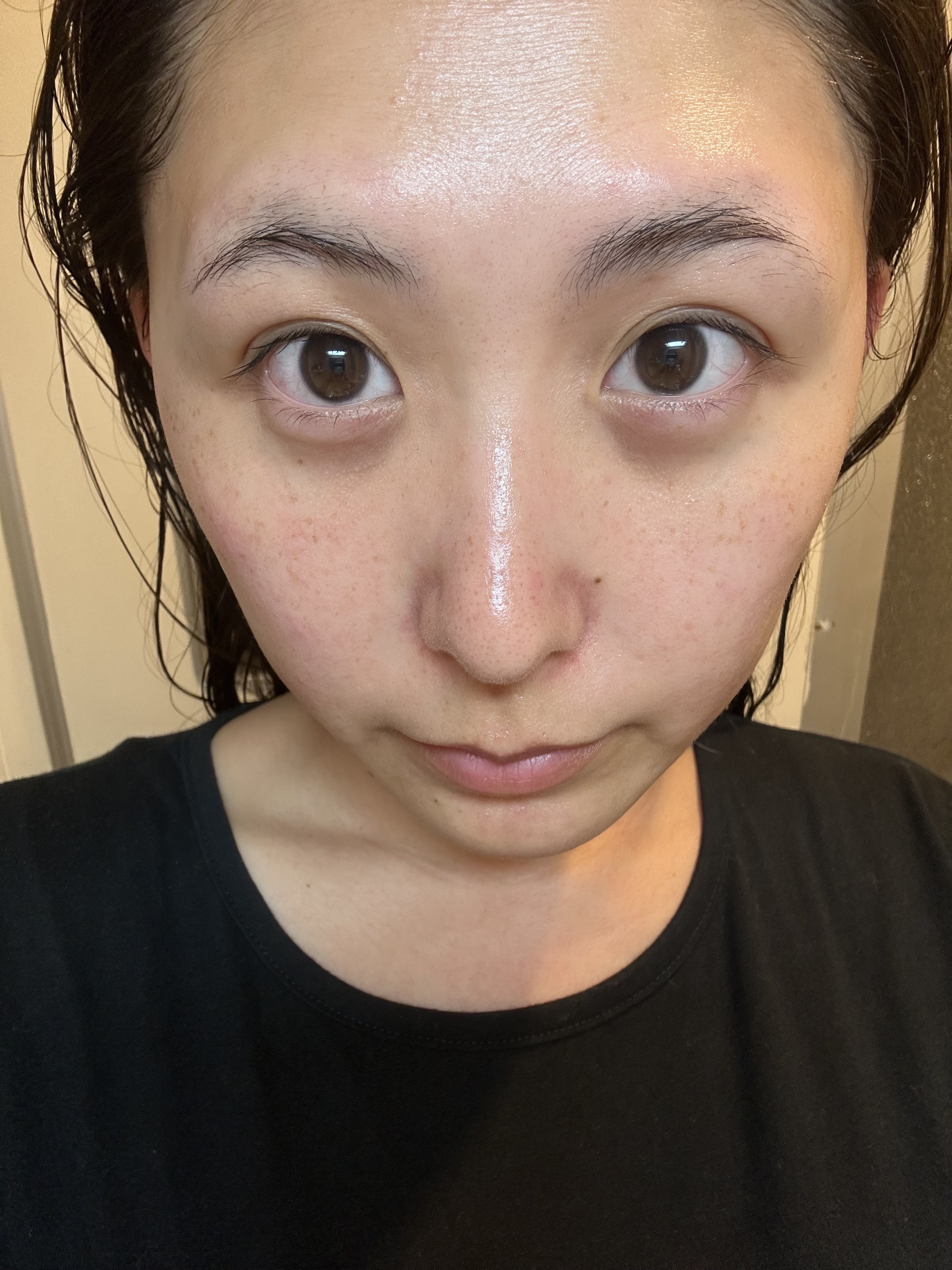 S100 レチAリードル/VT/美容液を使ったクチコミ（3枚目）