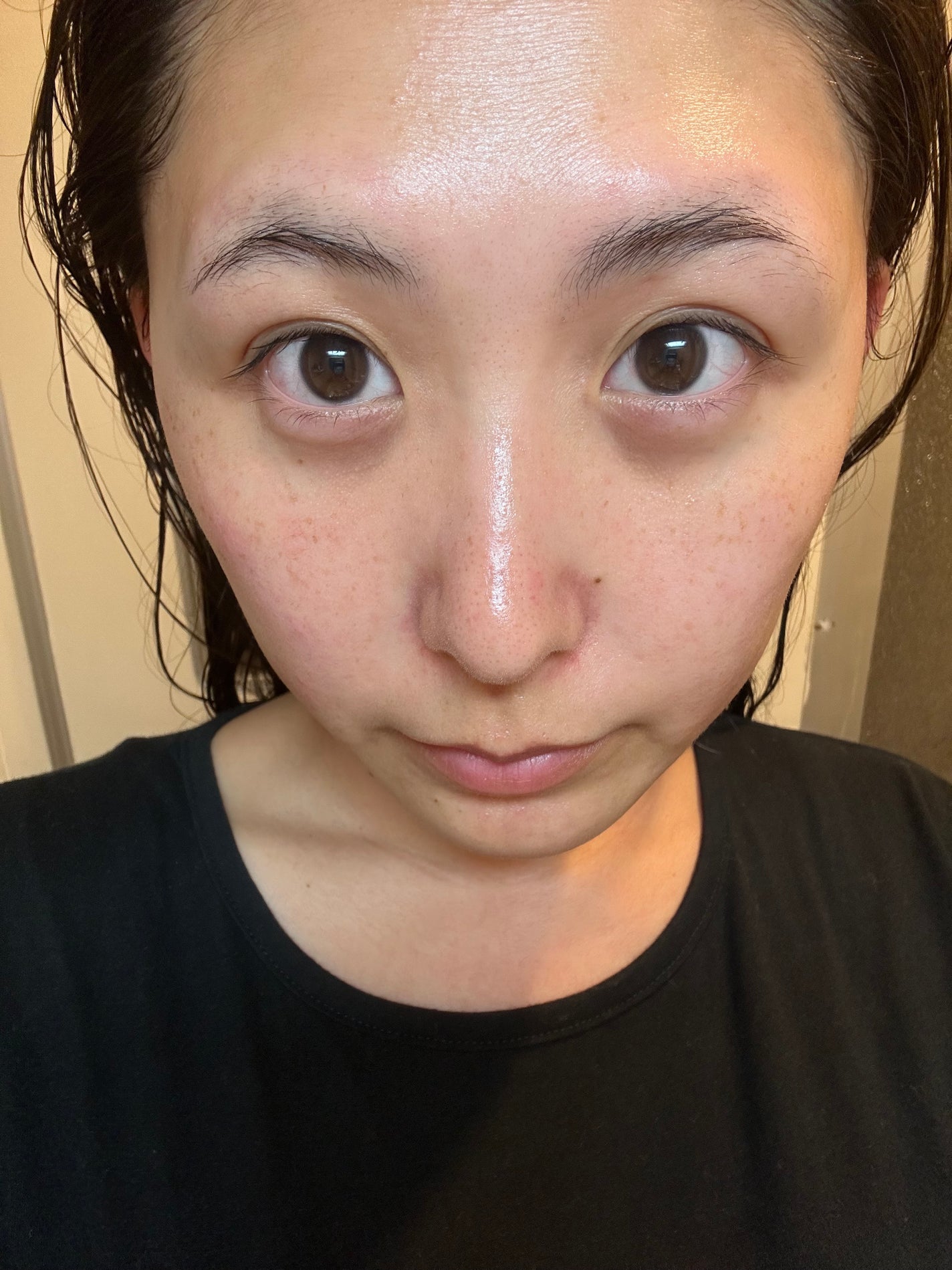 S100 レチAリードル/VT/美容液を使ったクチコミ(3枚目)