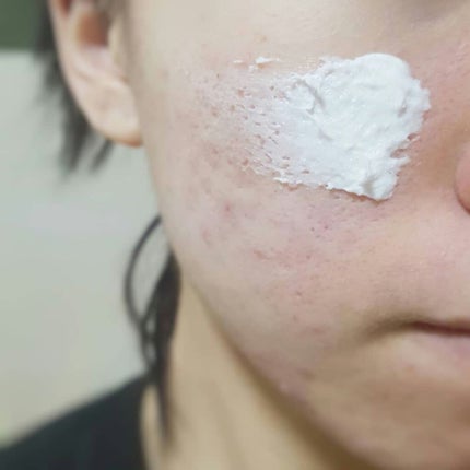 モッチスキン吸着もちパック/MoccHi SKIN/洗い流すパック・マスクを使ったクチコミ(3枚目)