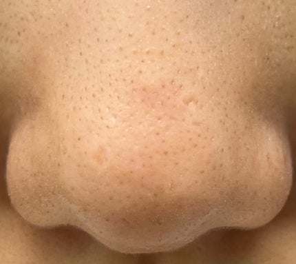 ムースネトワイアントCn/クレ・ド・ポー ボーテ/洗顔フォームを使ったクチコミ(8枚目)