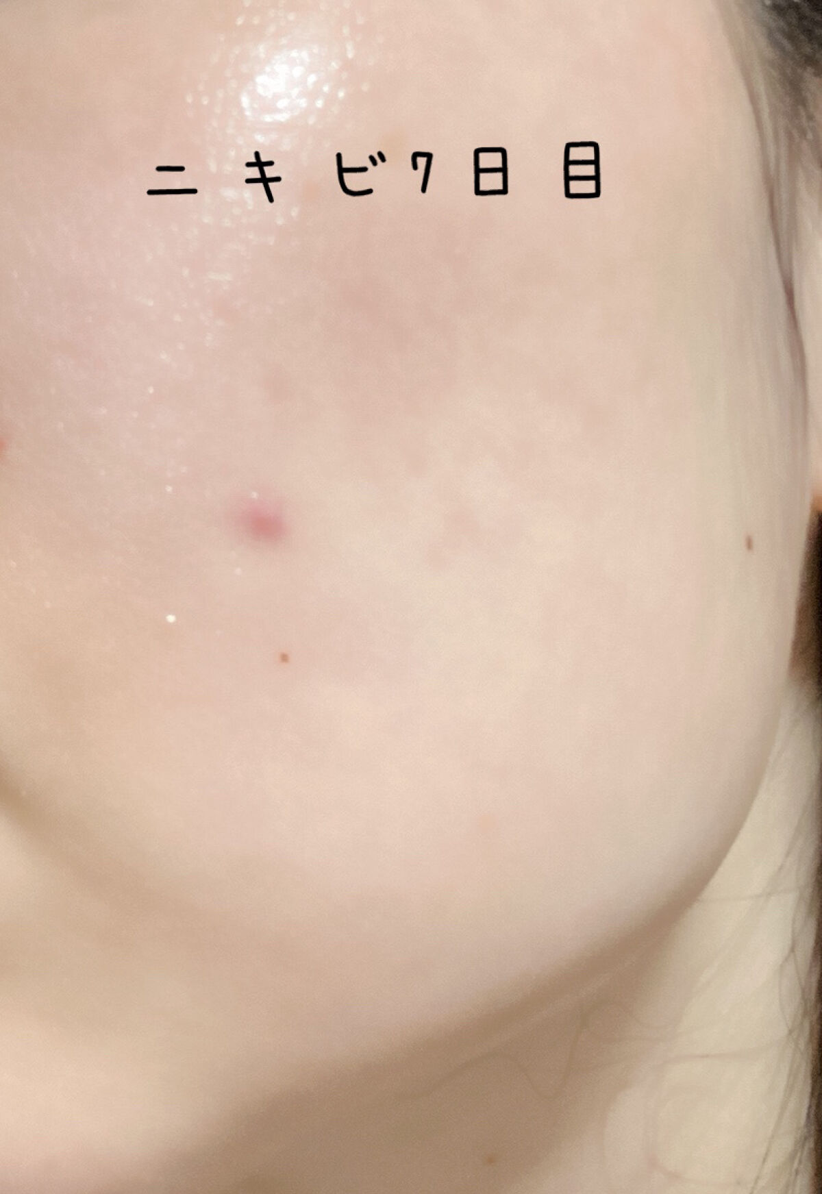 ホワイトアップ ローション(II)/アクアレーベル/化粧水を使ったクチコミ（1枚目）