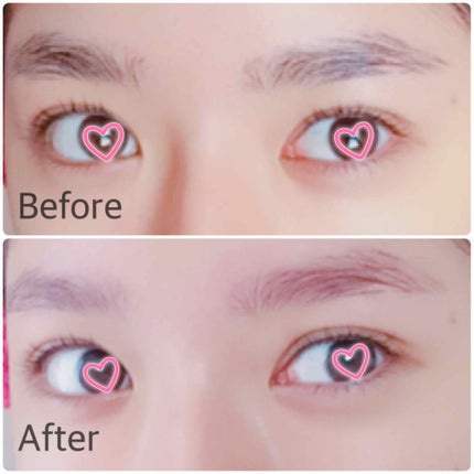 脱色クリーム スピーディー/エピラット/ムダ毛ケアを使ったクチコミ(1枚目)